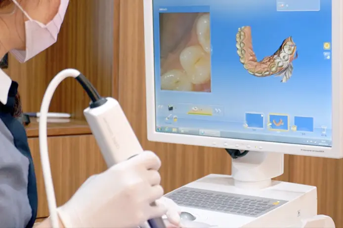 診断・口腔内スキャン
